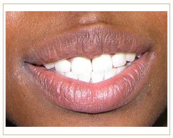 Slider image (10) PruDent-Hungary | Italian Patient Center